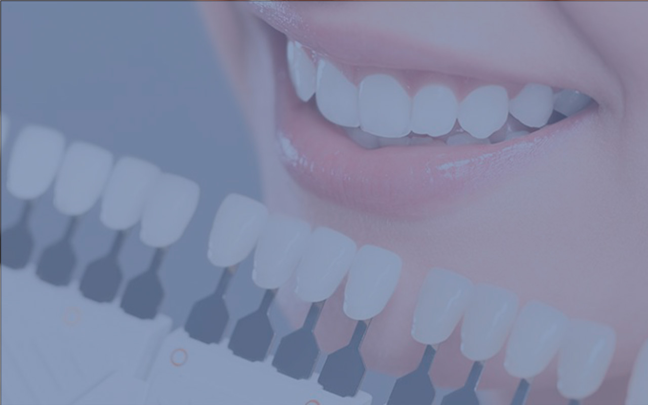 How to Take Care of Your Dental Veneers: A Complete Guide – Dental Clinic in Los Algodones México.